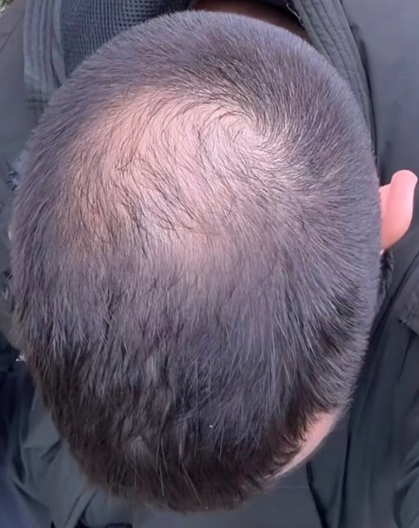 Преди